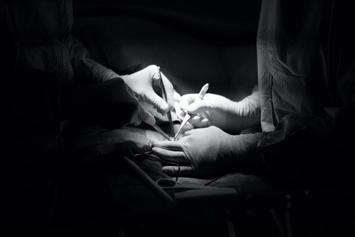 vasectomie,vasectomie genève