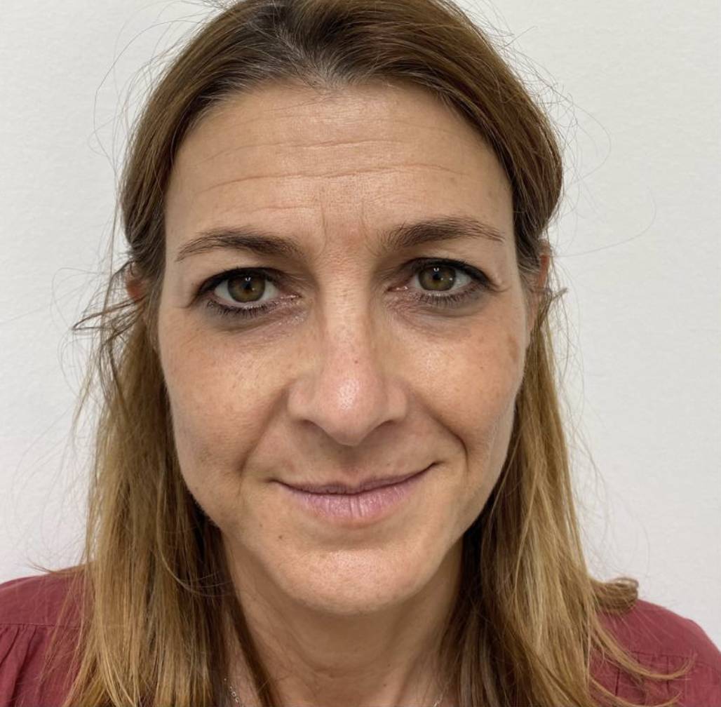 Lifting de face avant