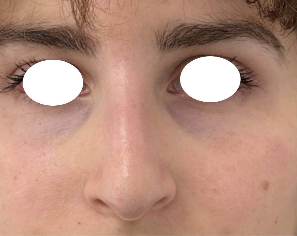 Rhino médicale après 1