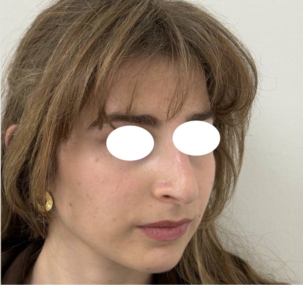 Rhino médicale après 2