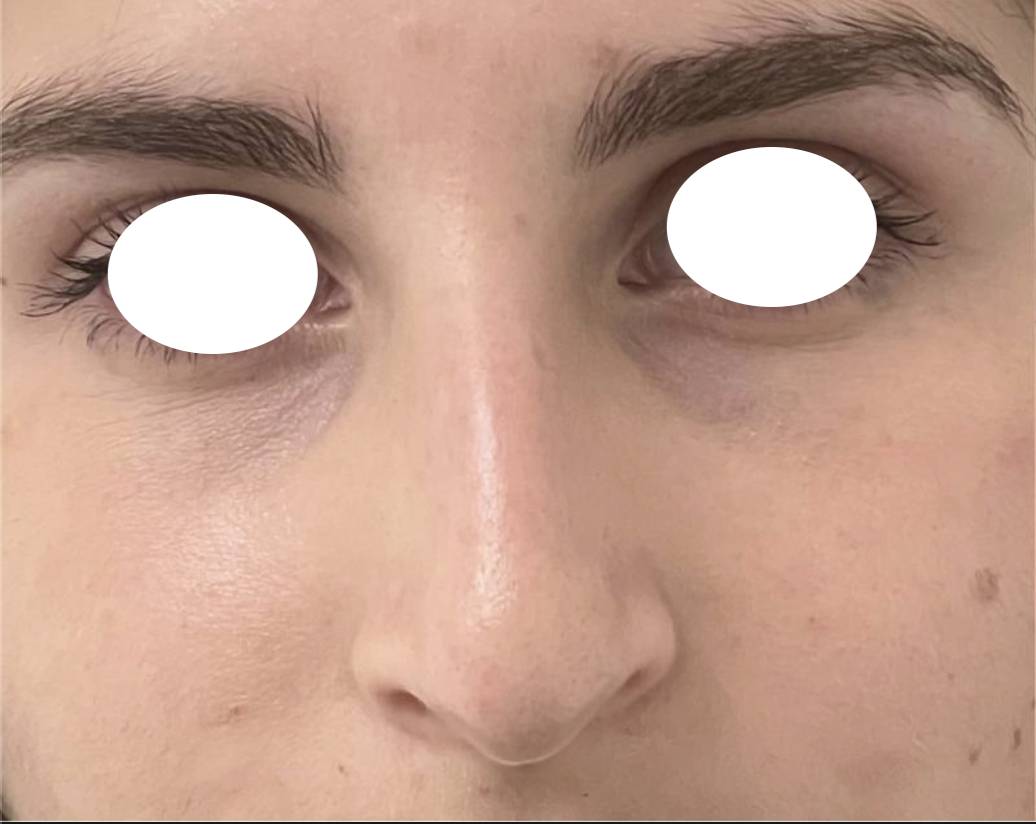 Rhino médicale avant 1