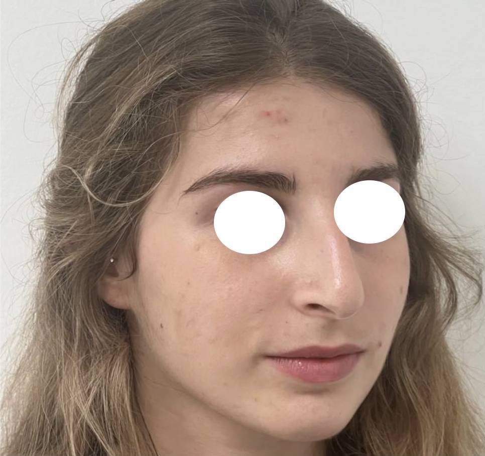 Rhino médicale avant 2