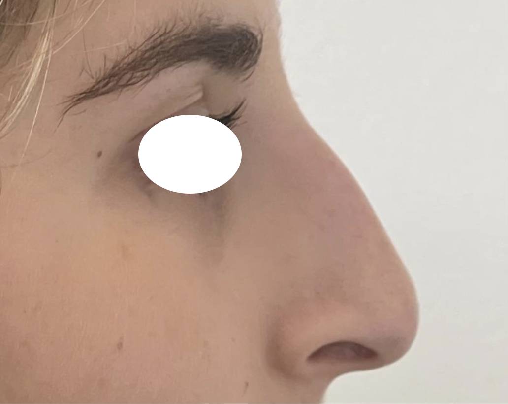 Rhino médicale avant 3